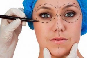 cirugia-facial-barcelona